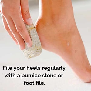Excellent advice from fixcrackedheels.co