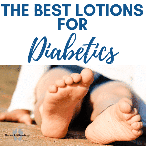 the best lotions for diabetics