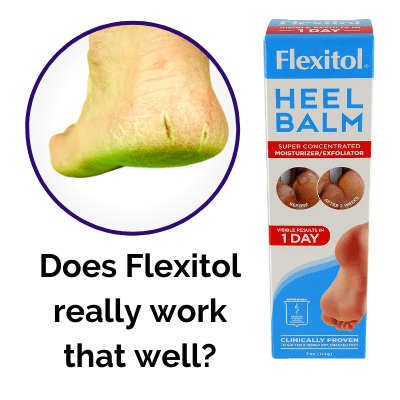 Does Flexitol really work that well?