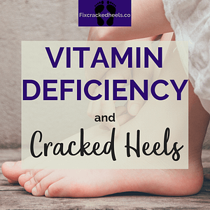 Vitamin deficiency and cracked heels