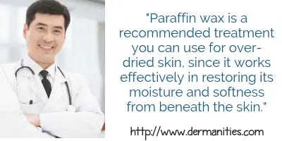 Learn how paraffin helps cracked heels