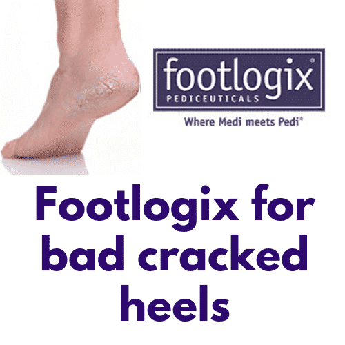 Try footlogix for bad cracked heels