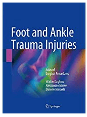 Foot and Ankle Trauma Injuries: Atlas of Surgical Procedures 1st-This full-color atlas offers a systematic guide to performing surgeries for the most common traumatic lesions of the foot and ankle. It features a wealth of didactic illustrations, achieved with a particular technique employing colors and transparencies that also reveals those anatomic structures that are not visible in the surgical field, but essential to a good outcome.
