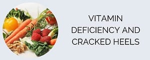 How I found out about Vitamin deficiency and cracked heels
