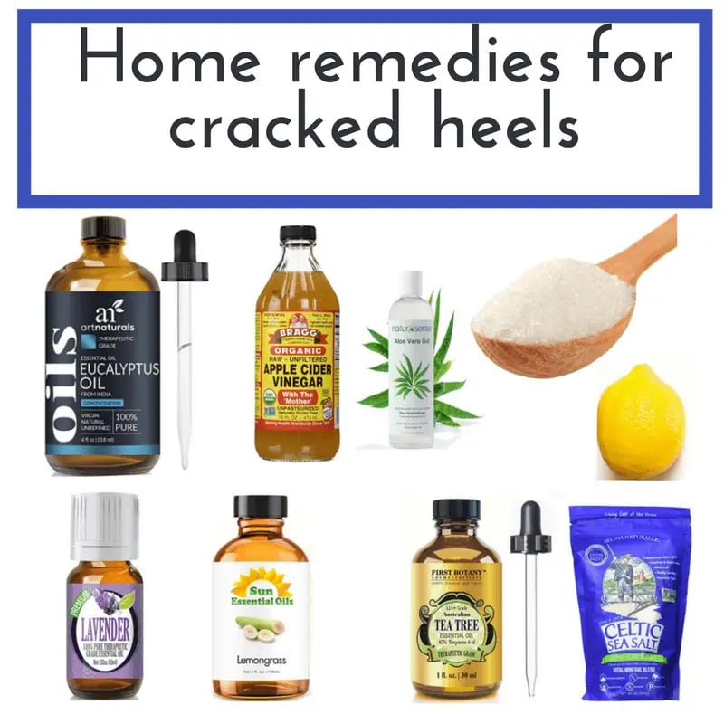 Home remedies for Cracked heels