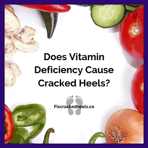 Does vitamin Deficiency CAuse Cracked Heels? To find out more click here.