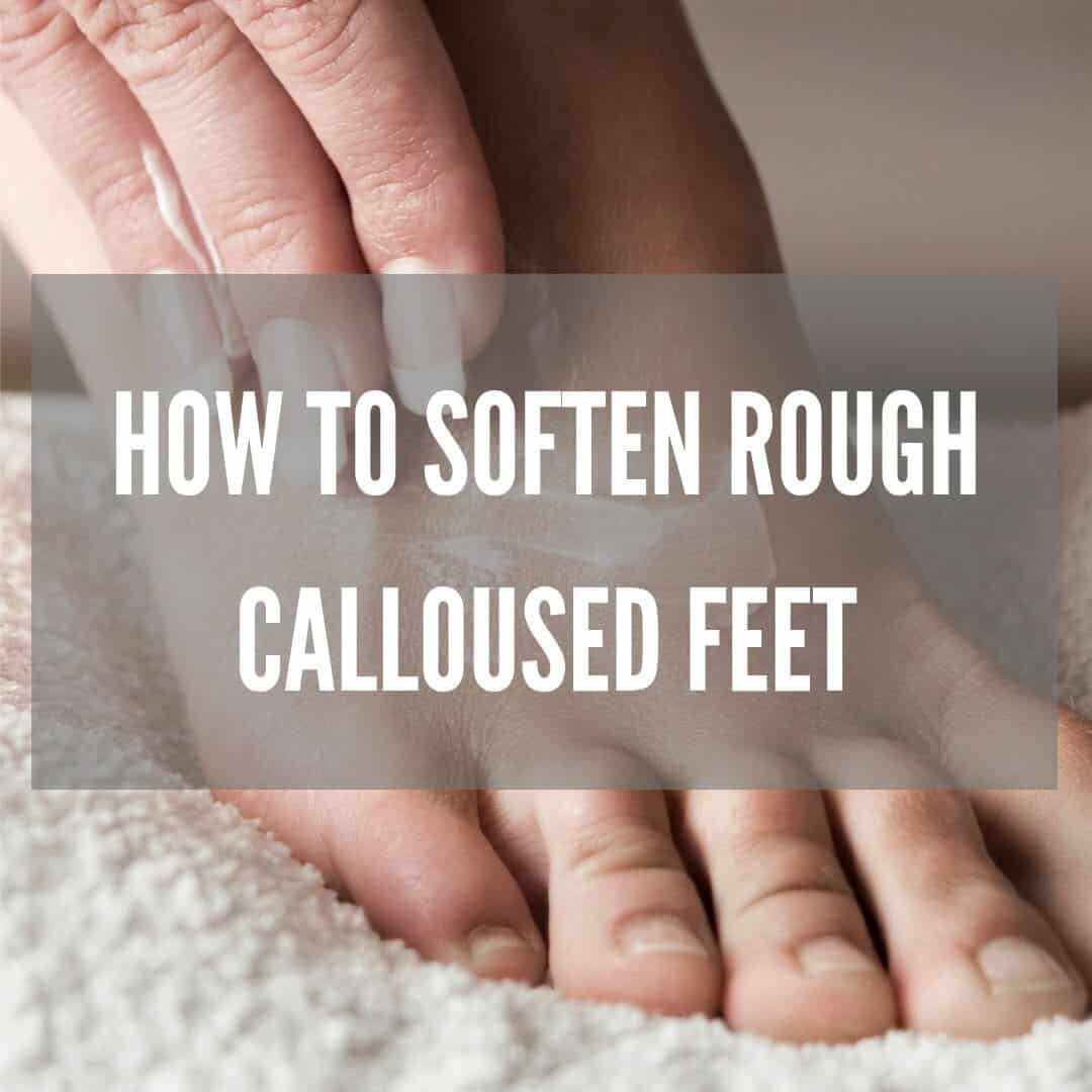 How to soften rough calloused feet