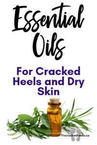 Essential-Oils for cracked heels