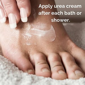 After you file your heels apply lotion to help get rid of cracked heels.