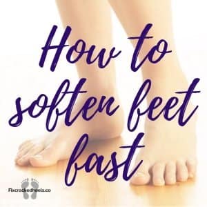 How to soften feet fast