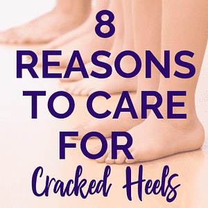 8 reasons to care for cracked heels