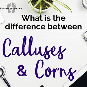 Corns vs Callus- What's the difference?